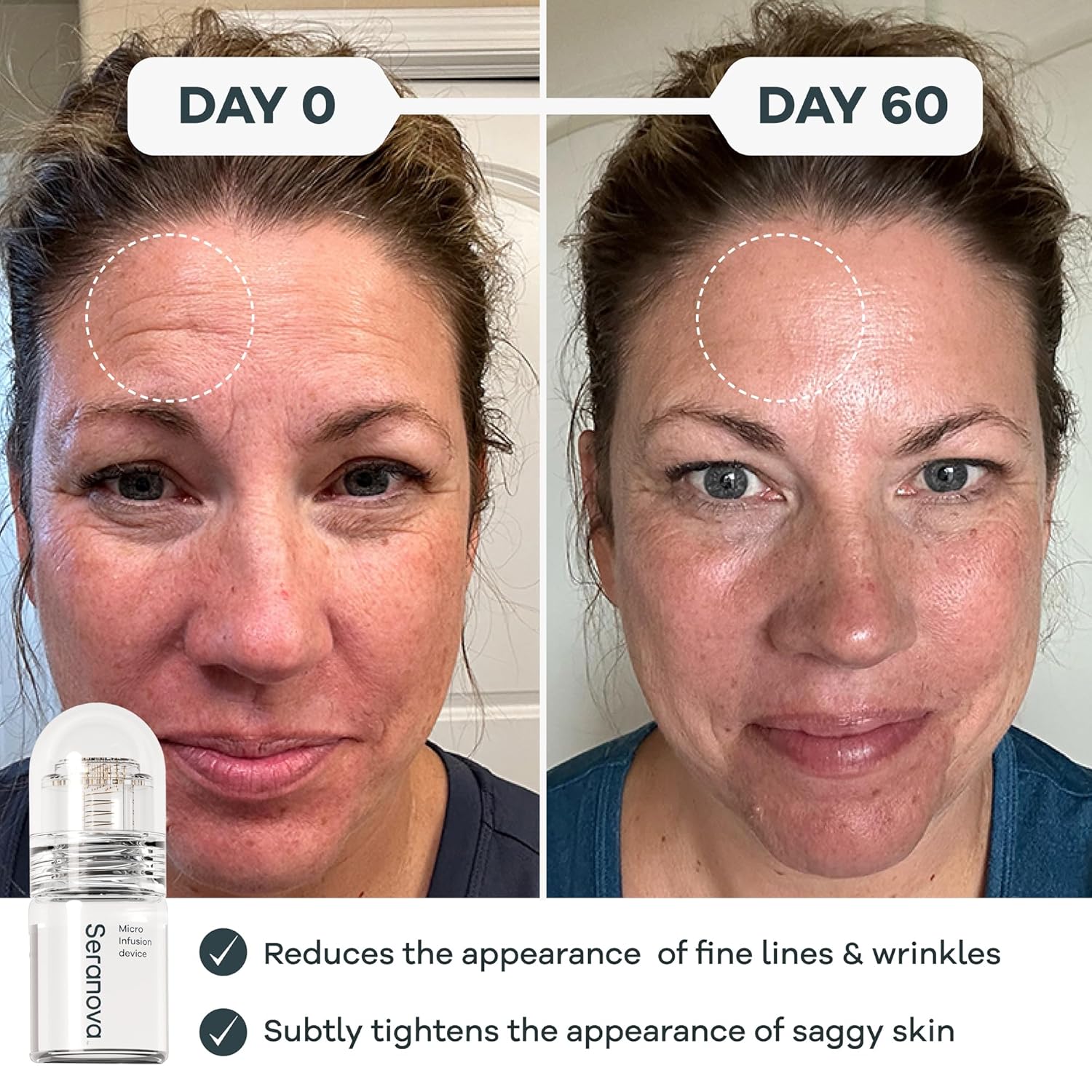 Seranova - Micro Infusion for Skin Care woman result